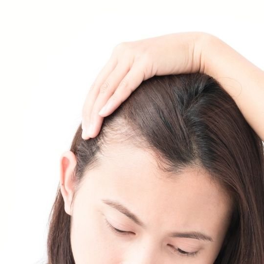 Hair Loss After birth